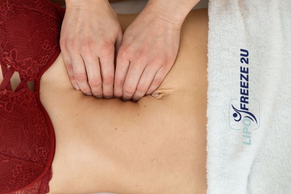 diastasis recti treatment Rutland