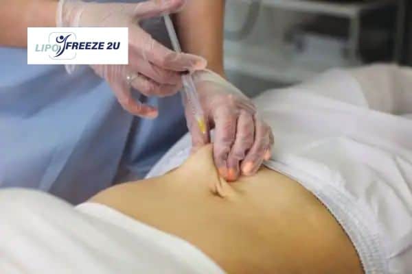 Fat Dissolving Injections Rutland & Weight loss medication