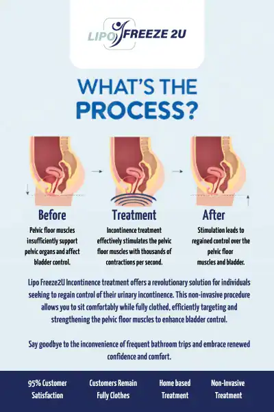 Diagram of how incontinence treatment Rutland works.