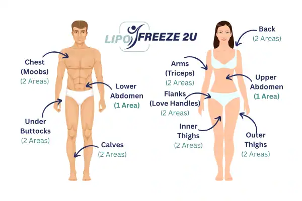 Areas you can have fat freezing treatment Rutland