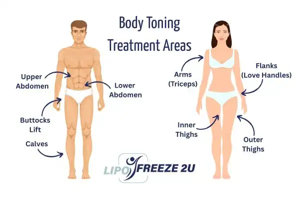 Graphic showing where you can have Body toning Treatment Rutland on your body
