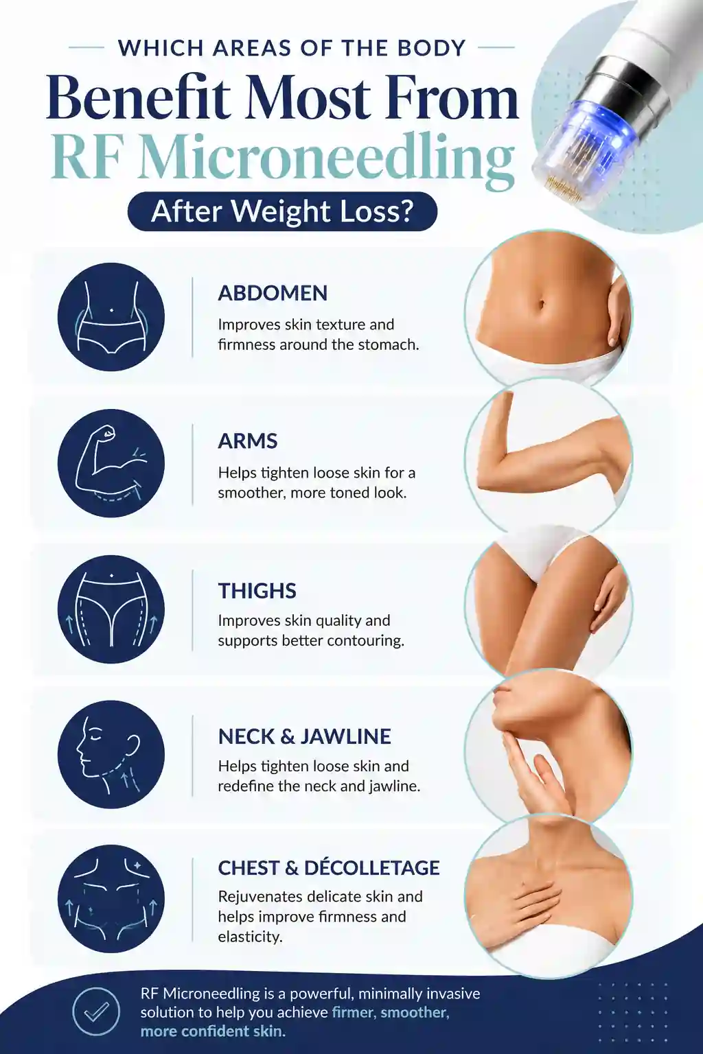 Which Areas of the Body Benefit Most From RF Microneedling After Weight Loss Rutland